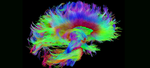 model of the structural connectivity of the human brain